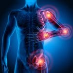 rhumatisme en naturopathie